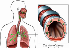 寒冬支氣管炎的高發(fā)期 補(bǔ)硒安全過(guò)冬