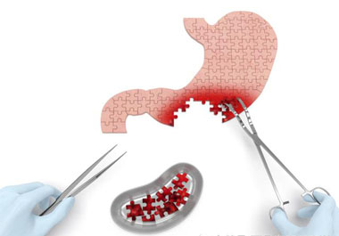 輕度脂肪肝不易被重視，但其危害隱蔽性大