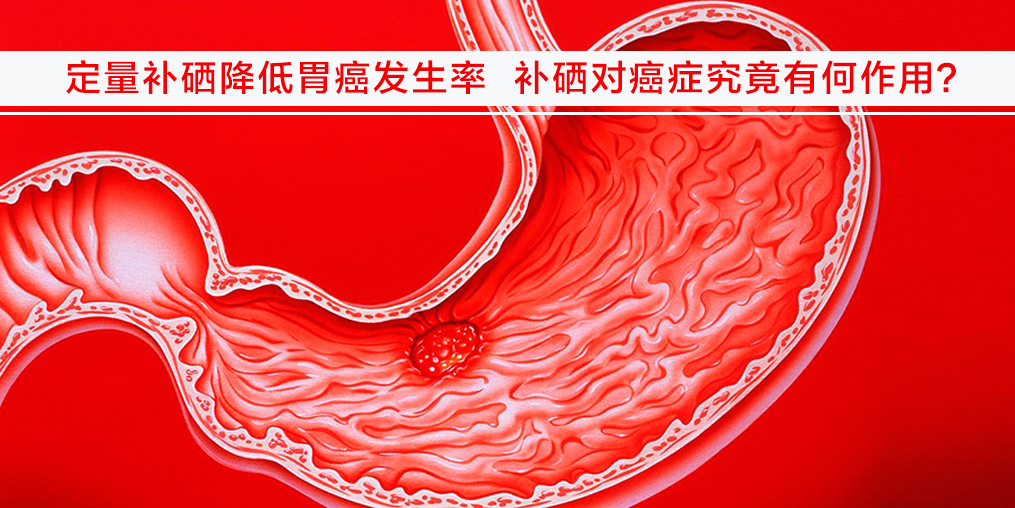 遠離胃癌不難，改變不良習(xí)慣外多補硒