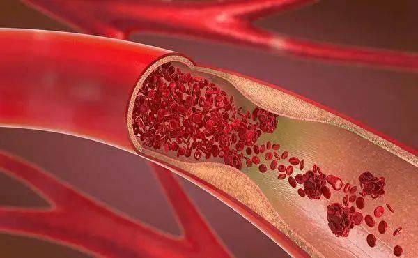 長期服用他汀類患者為什么要補充輔酶Q10？